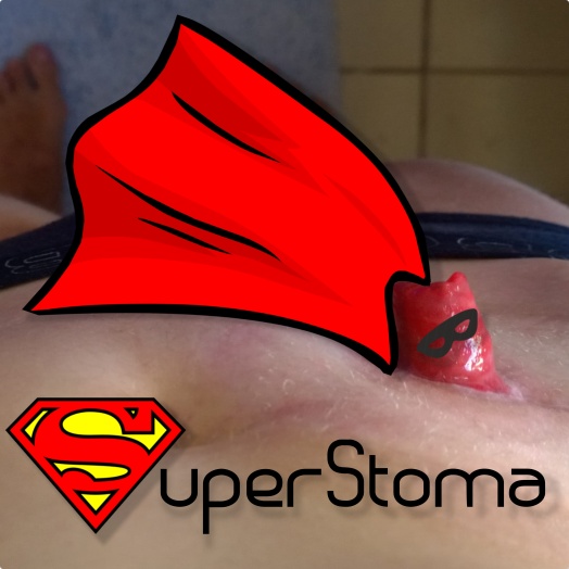 SuperStoma